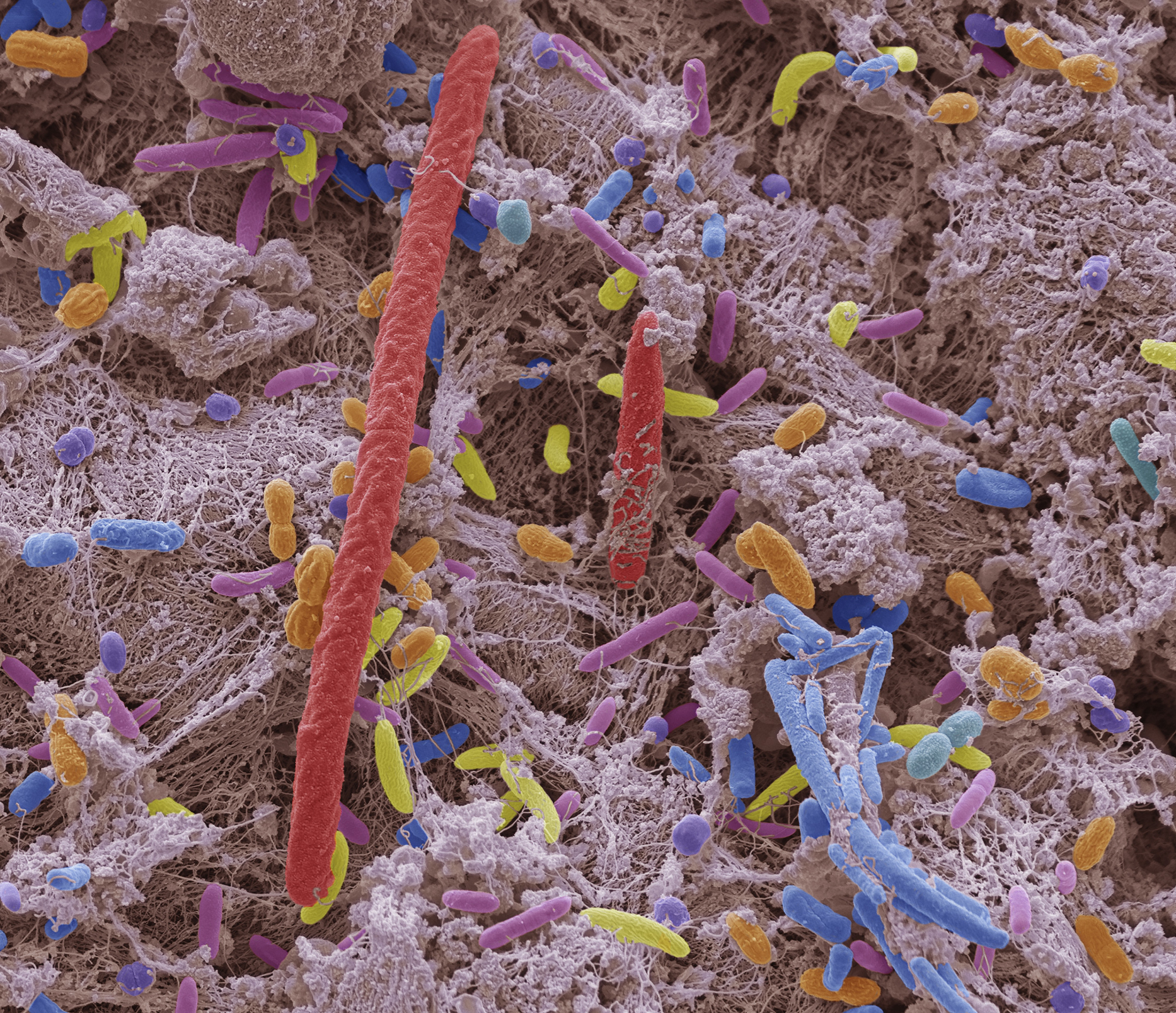 Микробы на коже человека под микроскопом