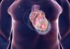 Experimental Drug May Reduce Heart Failure After a Heart Attack