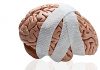 Advanced MRI Scan Identifies Currently Undiagnosed Long-Term Concussion Symptoms