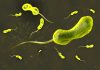 Genomic Traits Driving Cholera Symptoms and Transmission Uncovered