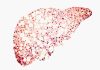 Three Distinct Types of Non-Alcoholic Fatty Liver Disease Discovered