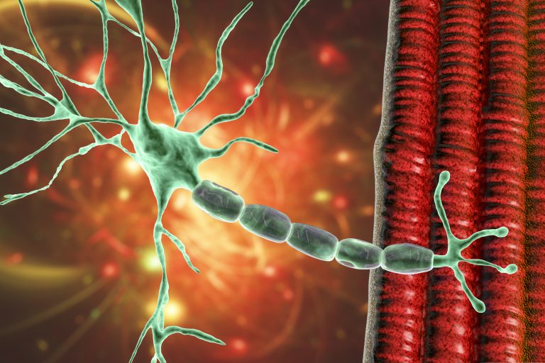 Motor neuron connecting to muscle fiber to illustrate myasthenia gravis