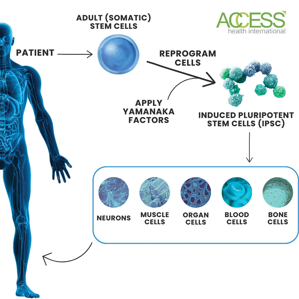 An infographic showing the process of creating IPSCs.