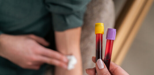 Female nurse holding blood collection tubes for liquid biopsy