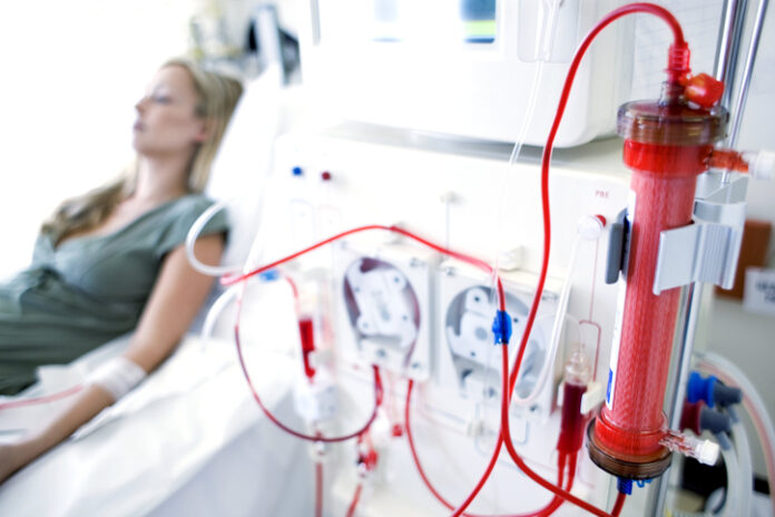 Young woman lying on a bed undergoing kidney dialysis to treat diabetic kidney disease