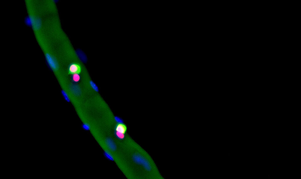 A microscope image of a muscle fiber 