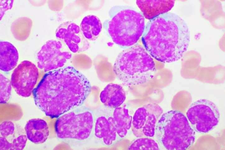 Chronic myeloid leukemia cells or CML