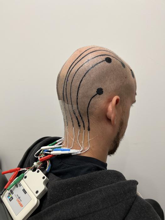 EEG setup with electronic tattoo electrodes