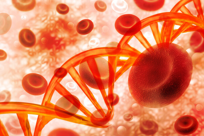 Beam Therapeutics Sickle Cell Base Editing Works, Not Cause of Patient Death