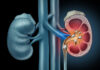 Study Reveals Kidney Microbiome’s Role in Kidney Stone Formation