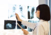 AI Enhances Breast Cancer Detection Rates, Can Reduce Radiologist Shortages