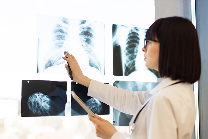 Doctor analyzing chest x-rays and mammograms in hospital